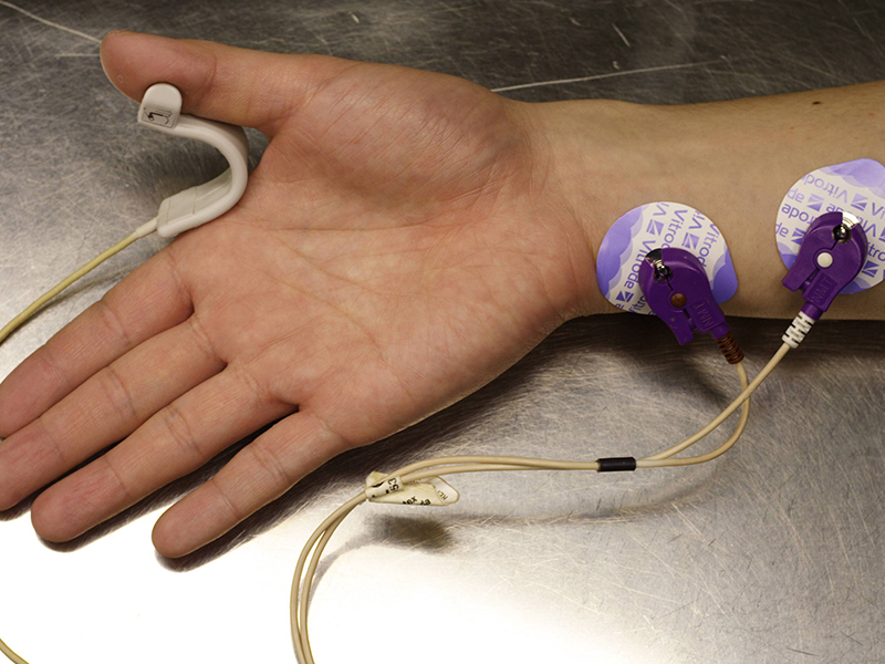 Ayurvedic Neuromuscular Disorders Treatment Paralysis Prakriti Chennai